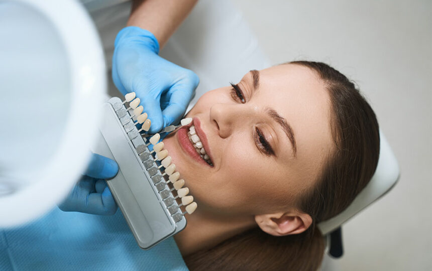 Things to know before opting for dental veneers